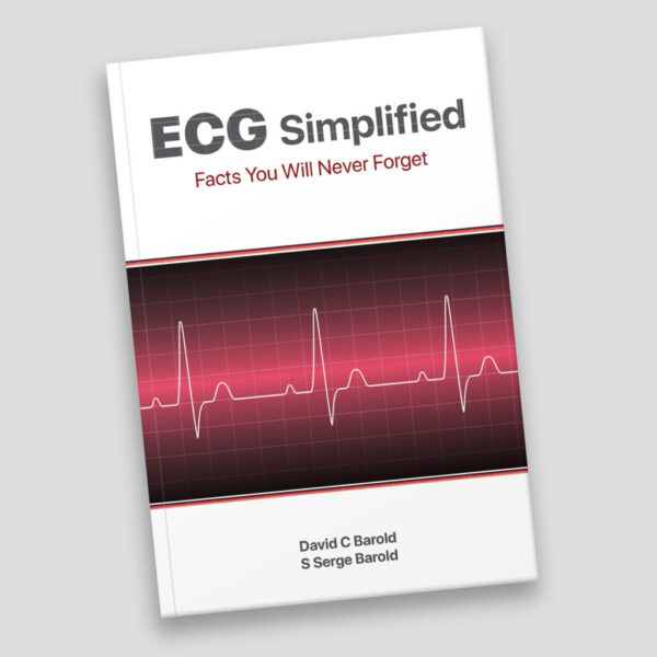 ECG Simplified Paperback